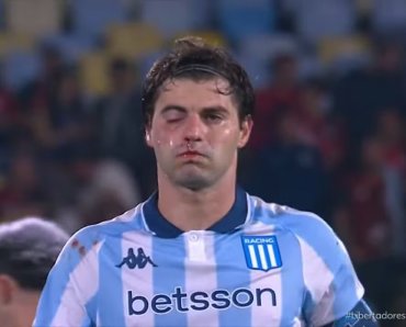 'Rocky'? Rosto 'detonado' de jogador do Racing viraliza após derrota
